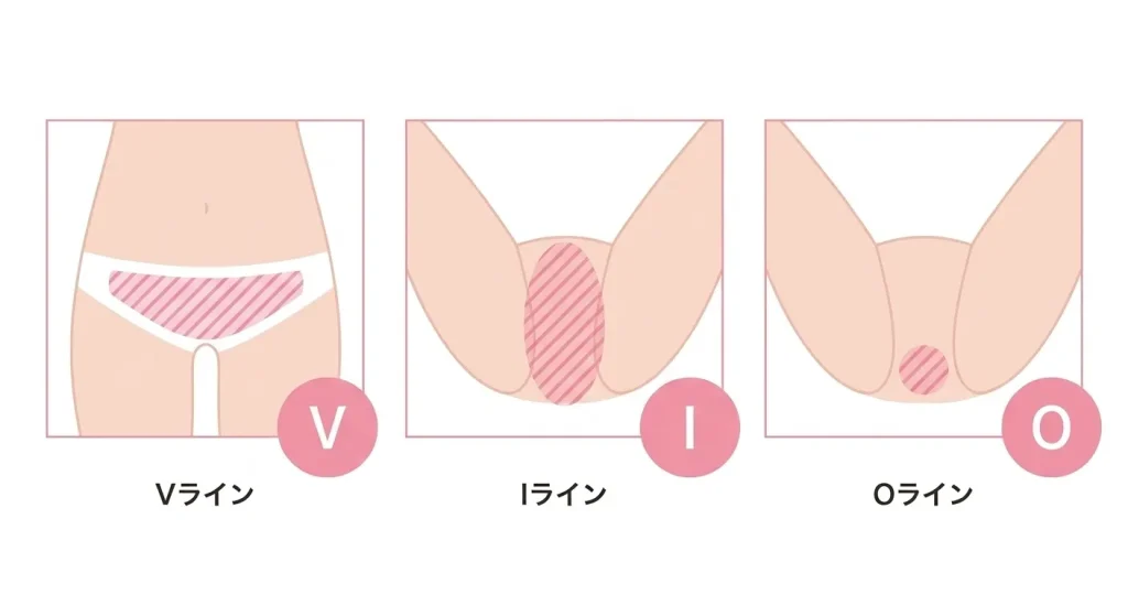 そもそもVIO脱毛とは?部位ごとの意味を解説