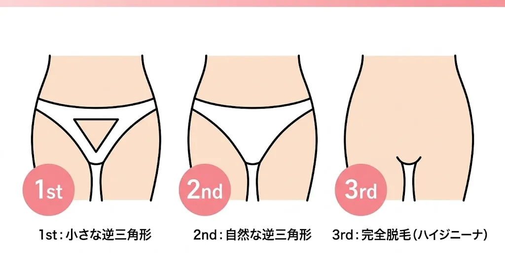 【ランキング】VIO脱毛で人気の形ベスト3