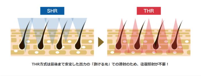 1.THR方式とは