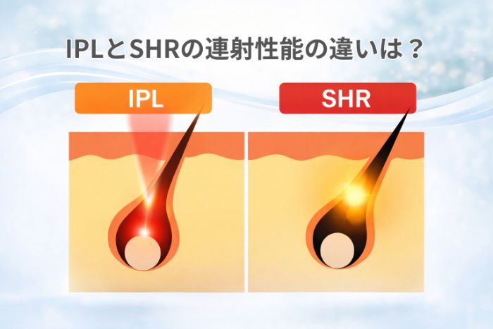 業務用脱毛機の連射性能を比較｜速さの「数字」に騙されないために