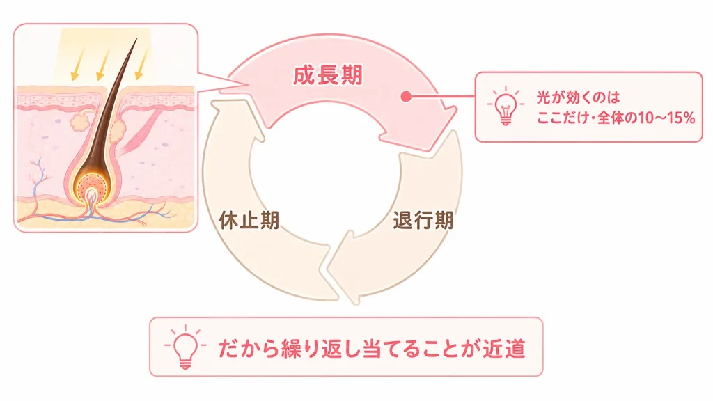 勘違い③「脱毛は5〜6回で終わる」